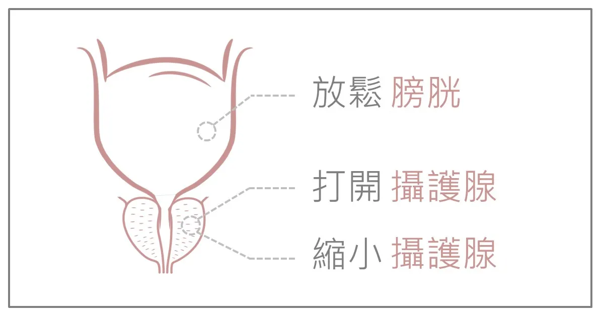 下泌尿道示意圖,以三條引導線標示三類藥物各自的作用位置:放鬆膀胱、打開攝護腺、縮小攝護腺。